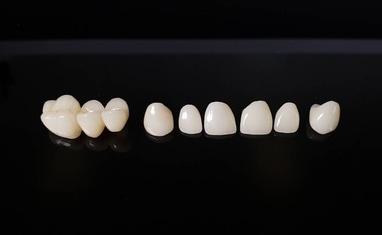 Стомадеус - Протезирование зубов – возможность вернуться к полноценной жизни - фото 2