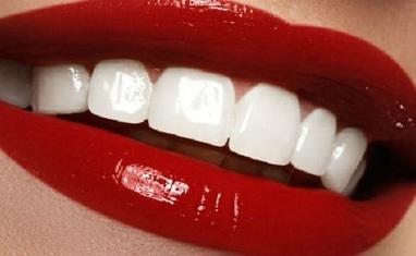 Стомадеус - Протезування зубів – можливість повернутися до повноцінного життя - фото 5