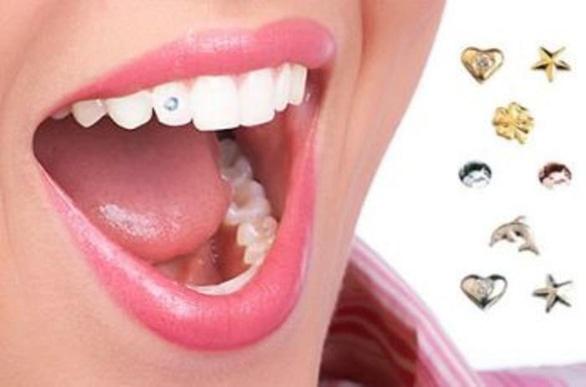 Сучасна Сімейна Стоматологія - Украшения на зубы: безопасно и красиво?