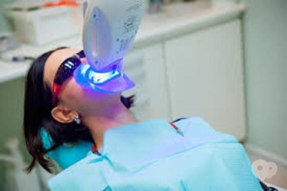 Сучасна Сімейна Стоматологія - Відбілювання або як повернути зубам білизн