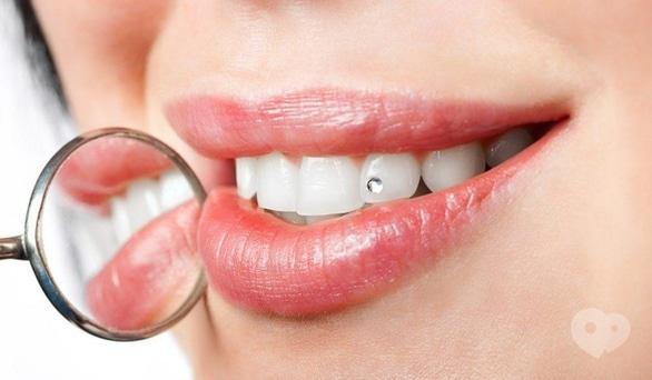 Сучасна Сімейна Стоматологія - Отбеливание зубов в домашних условиях. Безопасно?