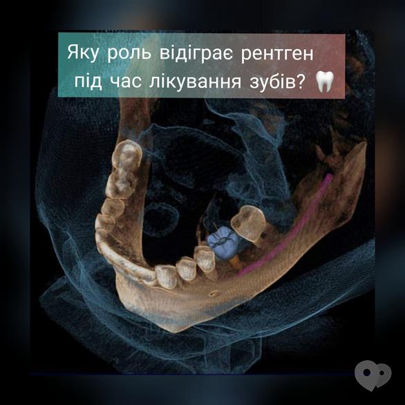 EcoSvit - Яку роль рентген відіграє під час лікування зубів?