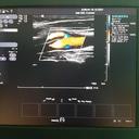 Фільм'УЗД судин голови та шиї (дуплексне сканування брахіоцефальних артерій, транскраніальне дуплексне сканування)' - фото 1