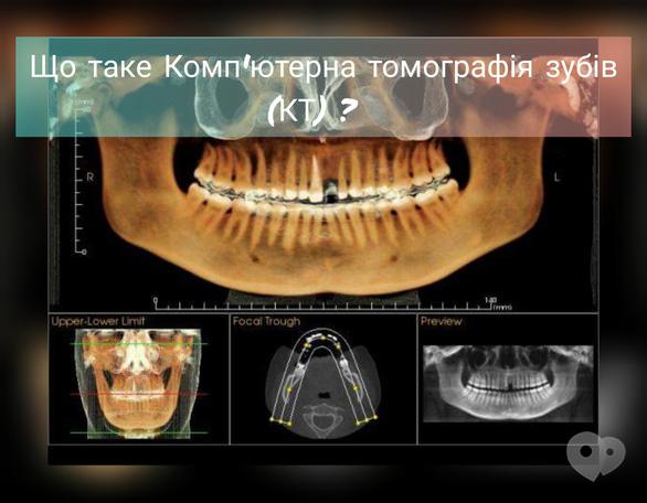 EcoSvit - Що таке Комп'ютерна томографія зубів (КТ) ?