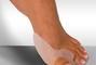 Вільний рух, медицинский центр - Лечение и коррекция плоскостопия и вальгусной деформации стопы ('шишки' на косточке большого пальца ноги)