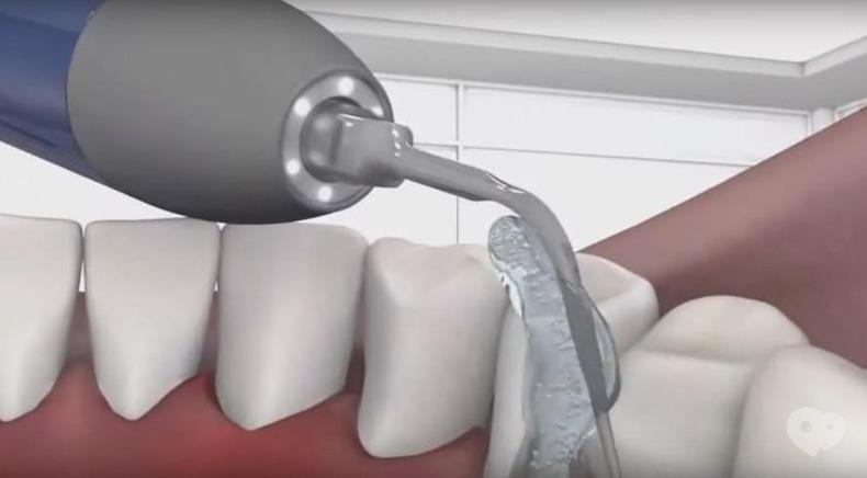 Багіта, стоматологічна клініка - Вектор-терапія