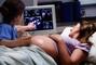 Авіцена, медичний центр - УЗД багатоплідної вагітності від 23 тижнів