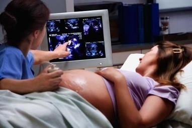 Авицена, медицинский центр - УЗИ многоплодной беременности от 23 недель