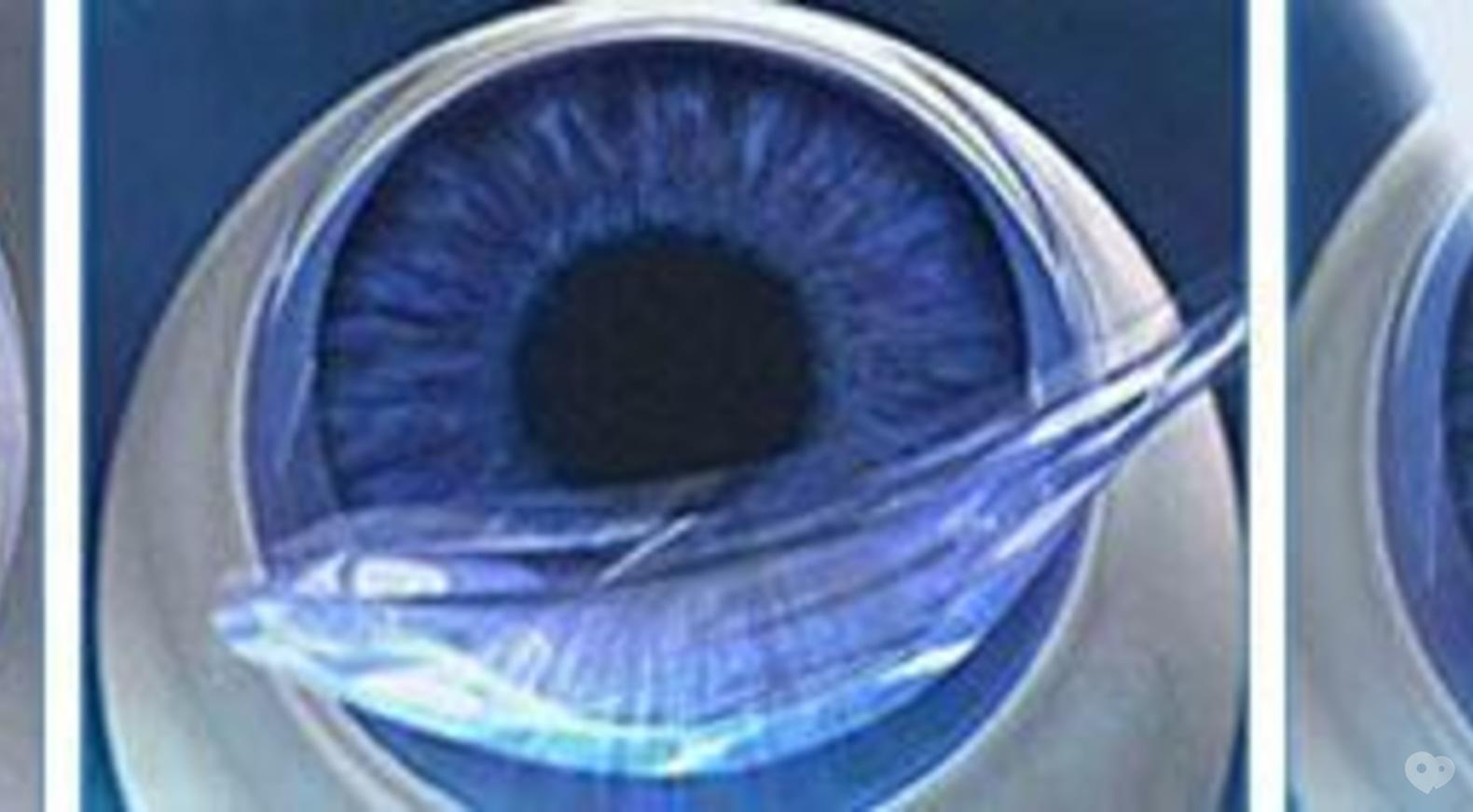 Лазерная коррекция зрения спустя много лет отзывы. Фемто супер ласик. Фемто ласик операция на глаза. Коррекция зрения по технологии Femto super LASIK. Коррекция зрения Фемто ласик Шуваев.
