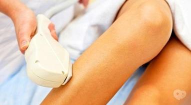 Мед-лазер, кабинет лазерной терапии - Единичный импульс по сосудистой сеточке на ногах