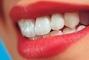 Сучасна Сімейна Стоматологія - Мала порожнина уражена карієсом