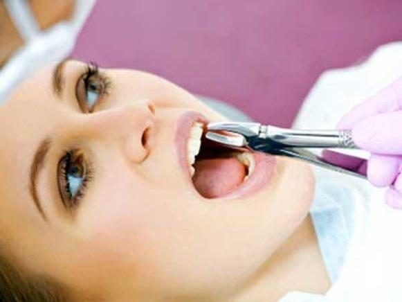 Сучасна Сімейна Стоматологія - Видалення зуба мудрості