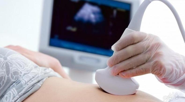 ОН Клінік, медичний центр - Роздруківка УЗД-зображення