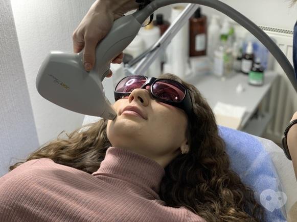 Фото 1 - Celebriti, центр лазерної косметології та корекції фігури - Лазерна епіляція зони обличчя
