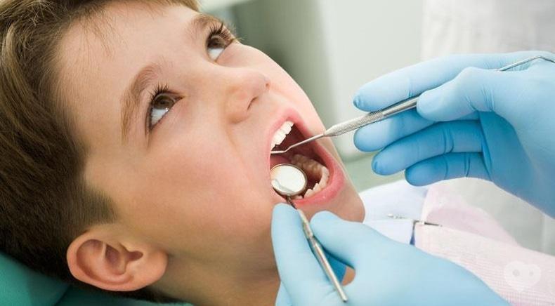 Сучасна Сімейна Стоматологія - Видалення молочного зуба