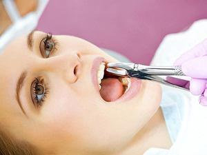 Стоматологія Соболевського - Атипове видалення зуба