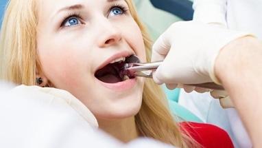 Стоматологія Соболевського - Видалення зуба (однокореневого)