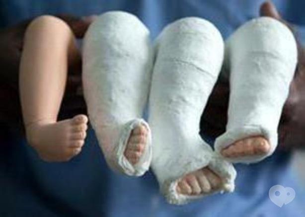 MEDГрація, ортопедичний реабілітаційний центр для дітей та підлітків - Виготовлення гіпсової лонгети дітям до 1 року (на 1 ніжку)