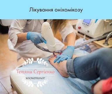 Сергиенко Татьяна Валерьевна, косметолог - Лечение онихомикоза