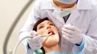 Smileup, стоматологія - Пломба GRADIA (фотополімерний матеріал)