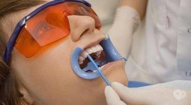 Smileup, стоматология - Реминерализирующая терапия
