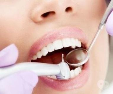 Smileup, стоматологія - Лікування однокореневого зуба