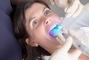 Smileup, стоматология - Лечение трехкорневого зуба