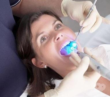 Smileup, стоматология - Лечение трехкорневого зуба