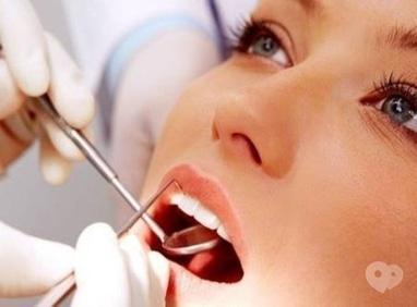 Smileup, стоматологія - Зняття зубних відкладень ультразвуком