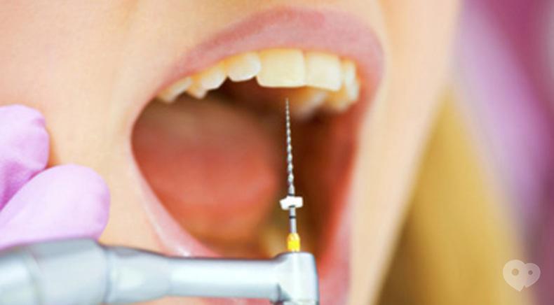 Сучасна Сімейна Стоматологія - Лікування каналів