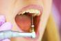Сучасна Сімейна Стоматологія - Лечение каналов