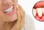 Сучасна Сімейна Стоматологія - Пародонтологія та лікування ясен