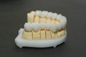 7 зірок, стоматологія - Ортопедичні послуги