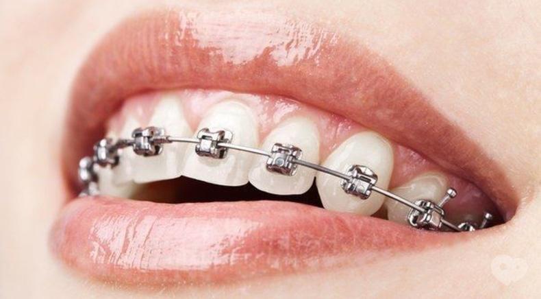 7 зірок, стоматология - Ортодонтия