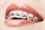 7 зірок, стоматологія - Ортодонтія