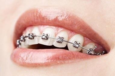 7 зірок, стоматологія - Ортодонтія