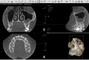 EcoSvit, кабінет діагностики - Комп'ютерна томографія однієї щелепи (верхньої або нижньої)
