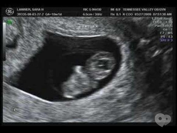 10 неделя беременности от зачатия: УЗИ плода, фото живота, что происходит с мамой и малышом