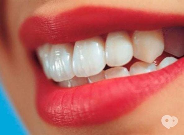 Стомадеус, стоматологическая клиника - Реставрация