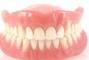 Стомадеус, стоматологическая клиника - Съемный протез