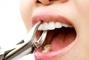 Стомадеус, стоматологічна клініка - Видалення зубів