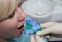 Стомадеус, стоматологічна клініка - Зняття відбитків