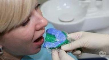 Стомадеус, стоматологічна клініка - Зняття відбитків