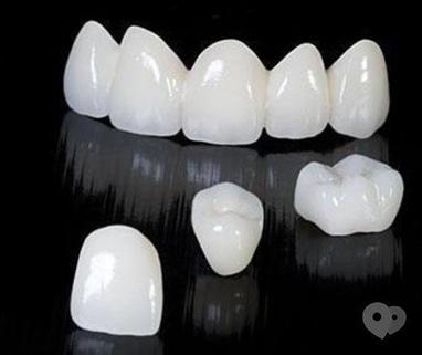 Стомадеус, стоматологічна клініка - Металокерамічна коронка