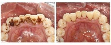 7 зірок, стоматологія - Комплекс проф. гігієни