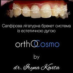 ORTHOCOSMO, Ортодонтичний комплекс сучасних стандартів лікаря Ковіти І.С. ORTHOCOSMO - Ортодонтичне лікування дорослих на лігатурних брекетах