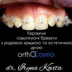 ORTHOCOSMO, Ортодонтический комплекс современных стандартов врача Ковита И.С. ORTHOCOSMO - Ортодонтическое лечение взрослых на самолигирующие брекетах