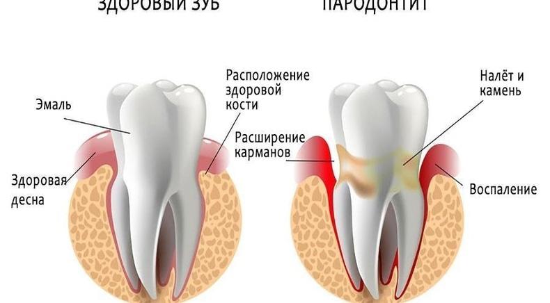 ORTHOCOSMO, Ортодонтический комплекс современных стандартов врача Ковита И.С. ORTHOCOSMO - Пародонтолог