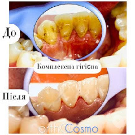 ORTHOCOSMO, Ортодонтический комплекс современных стандартов врача Ковита И.С. ORTHOCOSMO - Профессиональная гигиена