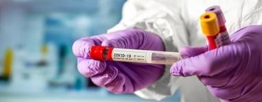 ОН Клиник, медицинский центр - Молекулярно-генетическое исследование (ПЦР Real-time) нового вируса COVID-19